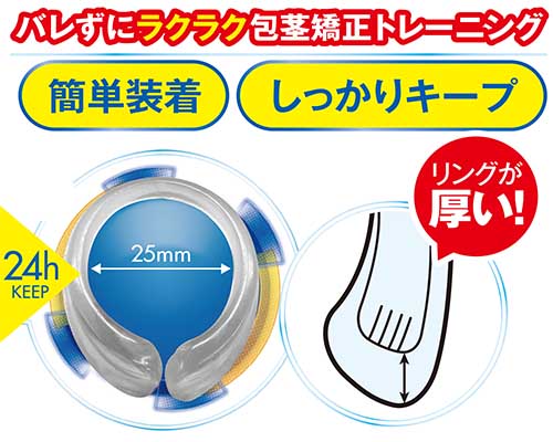 Pストッパー　M